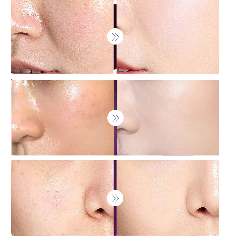 Роскошный благородный фотограф – обзор и цена Luxury Skincare Anti Aging