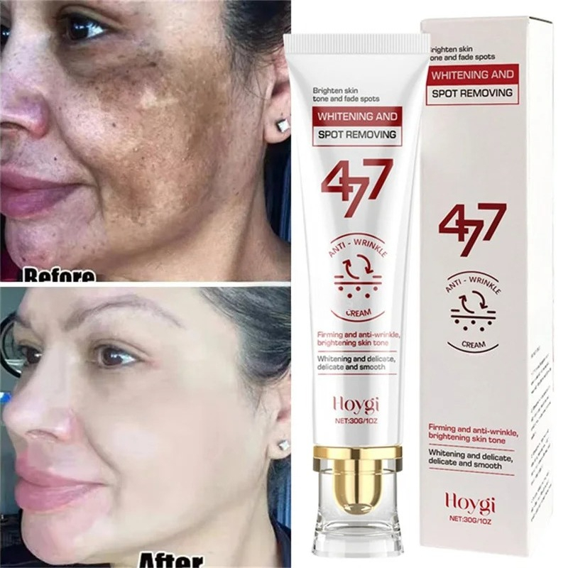 Мощный отбеливающий крем для у – обзор и цена Luxury Skincare Brands