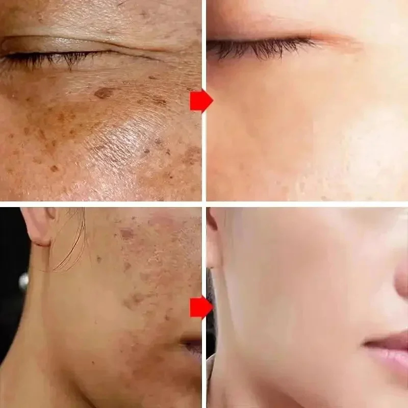 Мощный отбеливающий крем для у – обзор и цена Luxury Skincare Brands